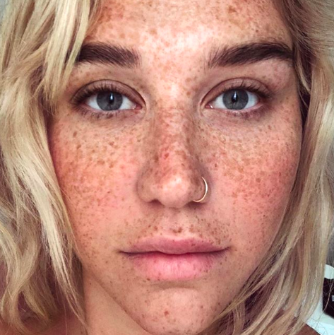 Kesha
